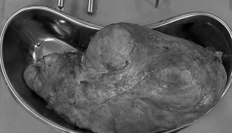 95-buou-than-la-ac-tinh