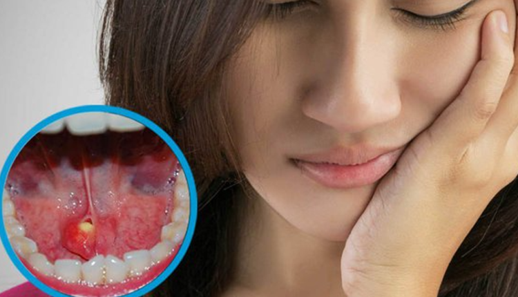 cach-loai-bo-soi-tuyen-nuoc-bot-tai-nha