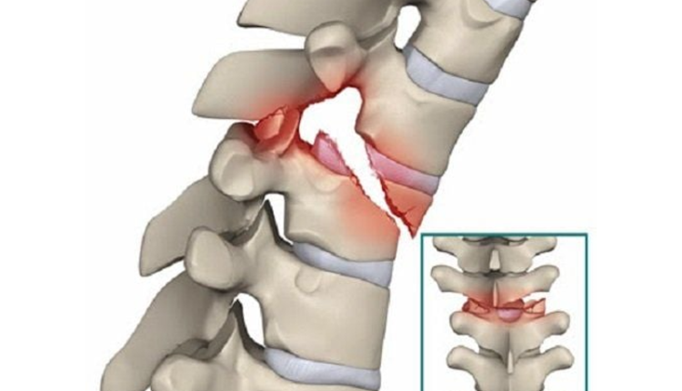 gay-cot-song-do-roi-thang-may