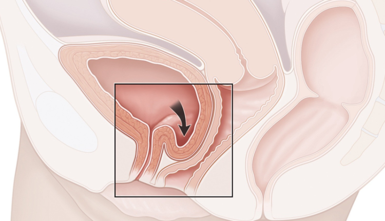 khong-dam-cuoi-lon-vi-sa-bang-quang