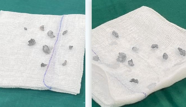 lay-20-u-khoi-num-vu