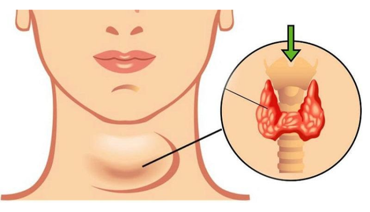 nghi-phai-thay-tim-ai-ngo-bi-cuong-giap