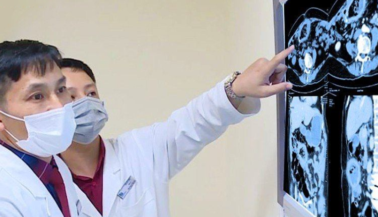 phat-hien-gac-ton-tai-gan-10-nam-trong-bung-benh-nhan