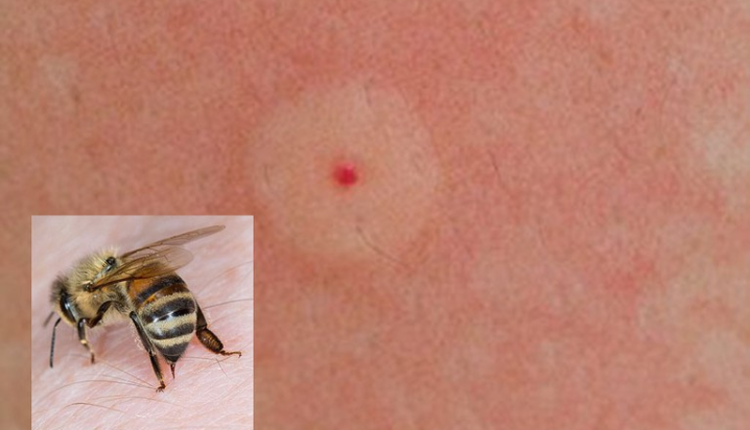 suy-than-cap-do-ong-vo-ve-dot