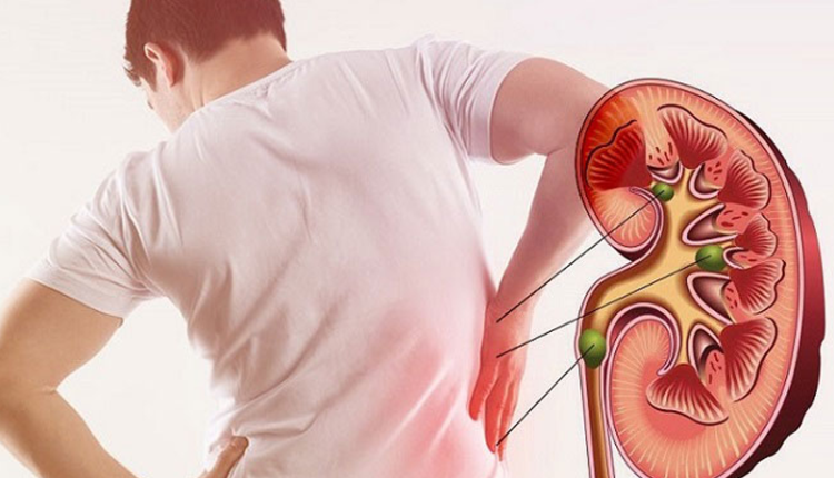 suy-than-nang-sau-khi-uong-co-muc