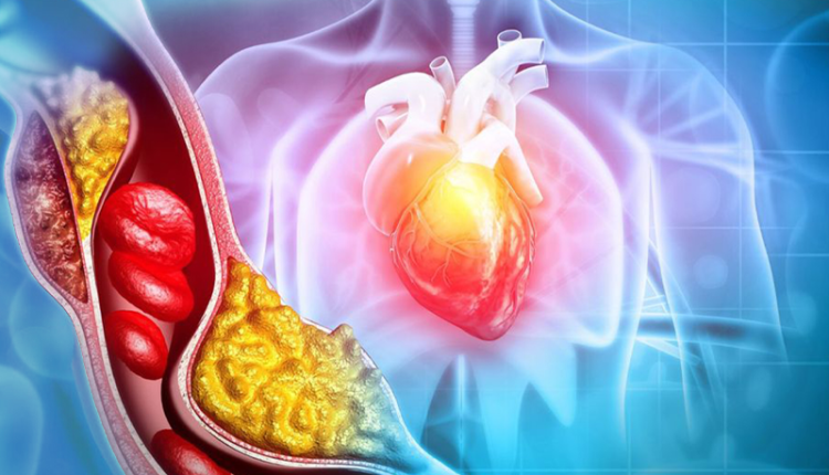 tac-hep-mach-mau-tim-sau-5-nam-chay-than