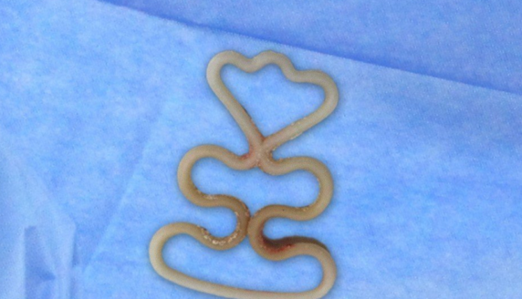 thao-vong-tranh-thai-cho-cu-ba-80-tuoi