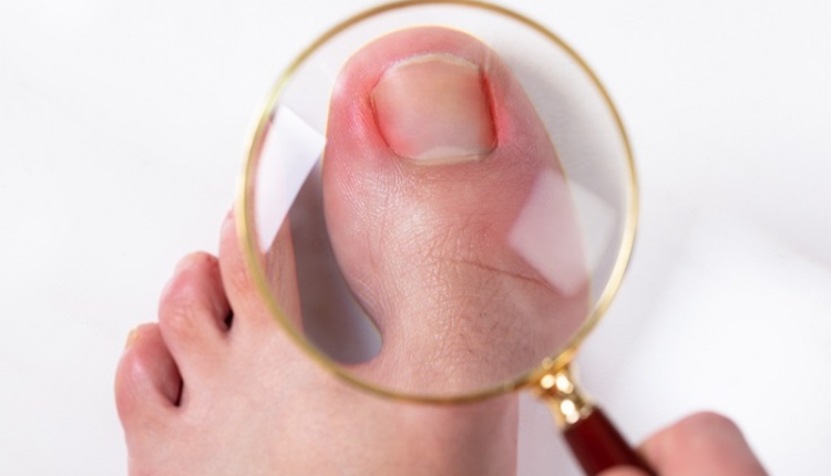 tre-dau-nhuc-mung-mu-ngon-chan-do-cat-mong-sai-cach