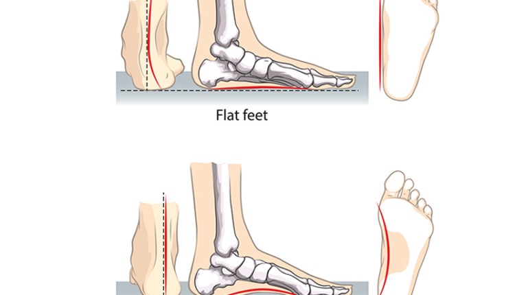 tre-di-lach-bach-phat-hien-ban-chan-bet